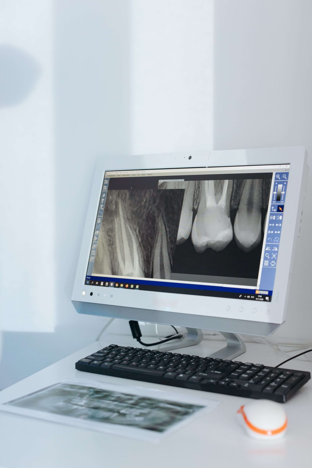 Ultrasound Radiographer Grade 1–3 Ultrasound Radiographer Grade 1–3